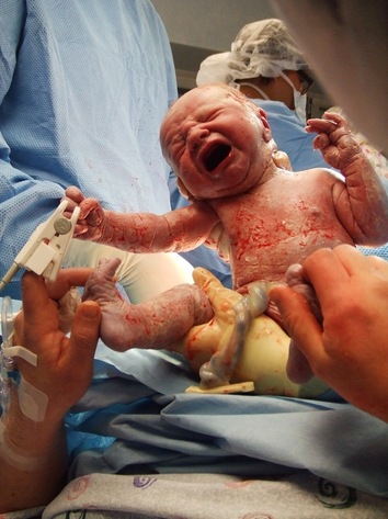 C-section| Birth Doula | Jacksonville, Florida